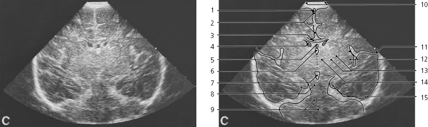 cmp34-fig-5573