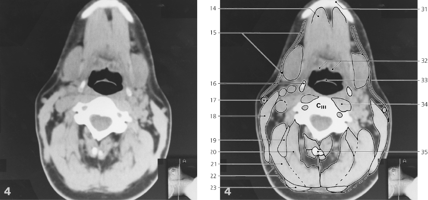 CT Series | Radiology Key