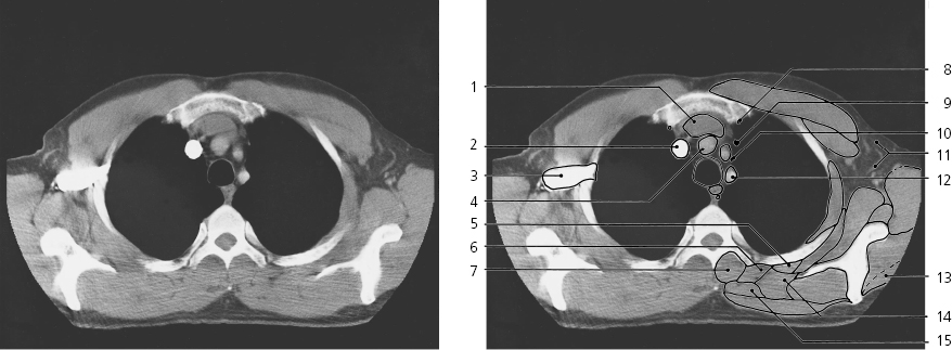 cmp40-fig-5630