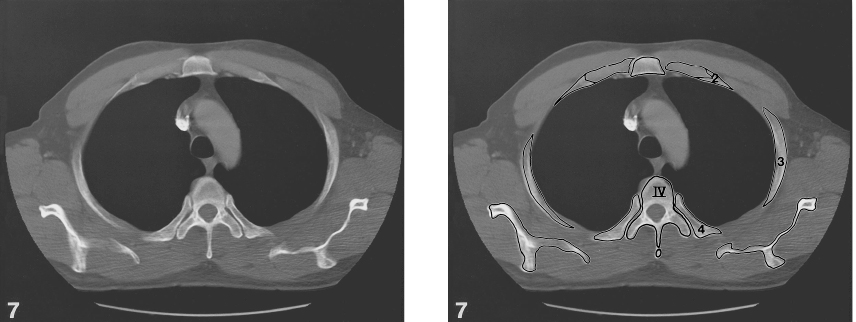 cmp40-fig-5635