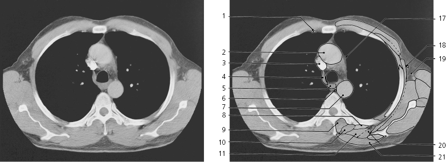 cmp40-fig-5642