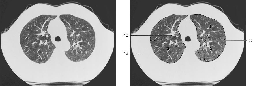 cmp40-fig-5643