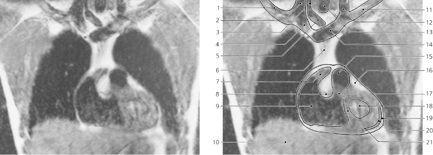 cmp41-fig-5716