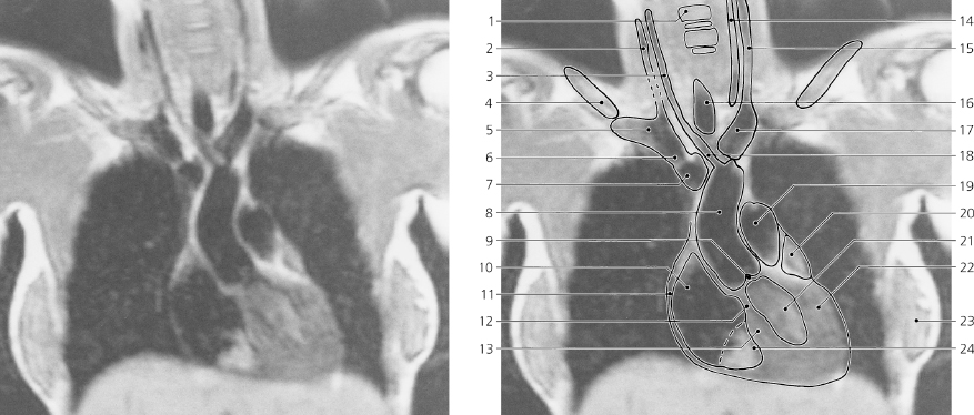 cmp41-fig-5717