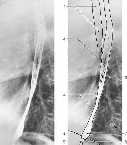 Esophagus | Radiology Key