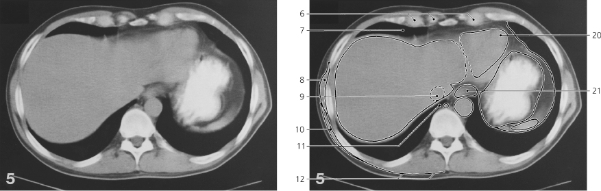 cmp45-fig-5753