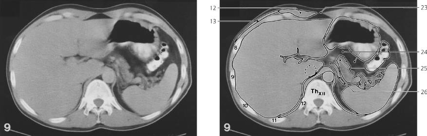 cmp45-fig-5757