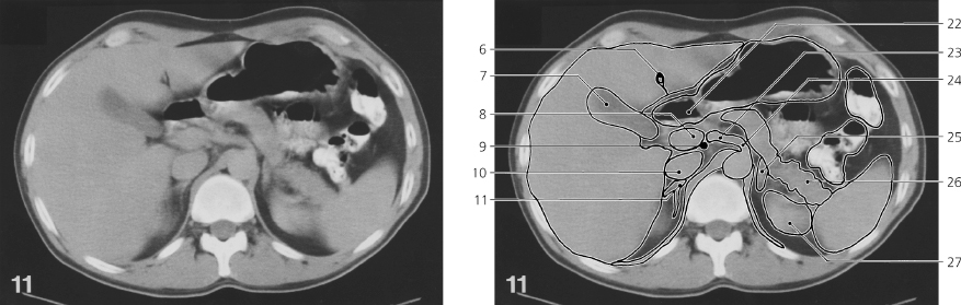 cmp45-fig-5759