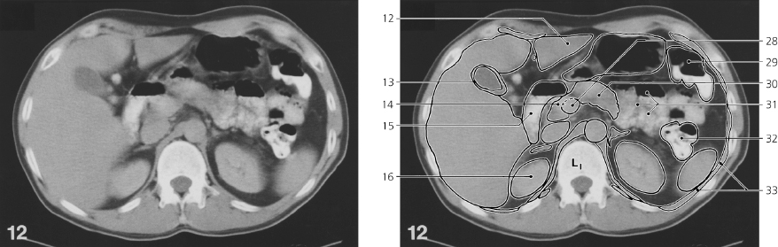 cmp45-fig-5760