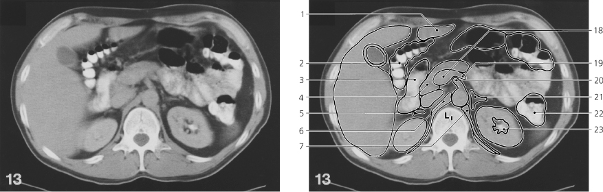 cmp45-fig-5761