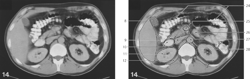 cmp45-fig-5762