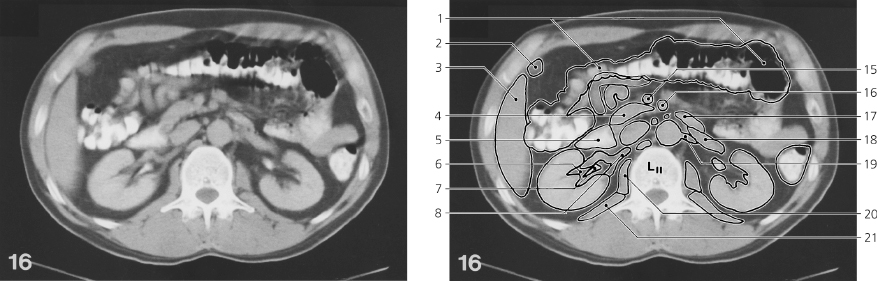 cmp45-fig-5764