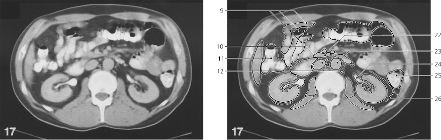 cmp45-fig-5765