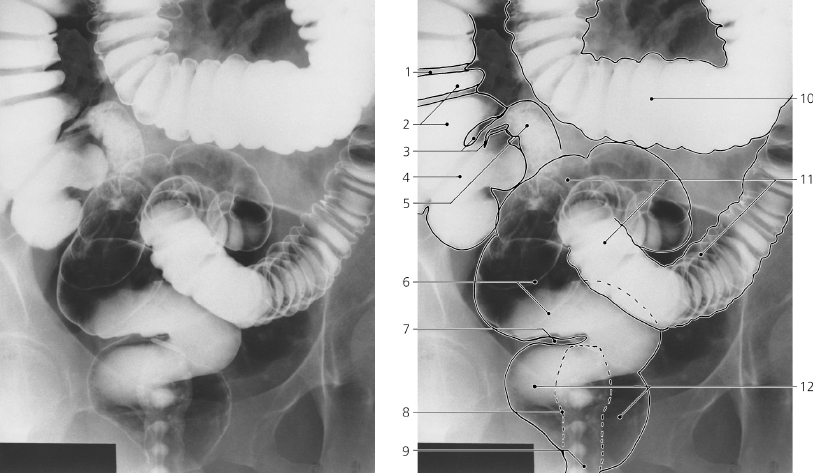 cmp48-fig-5811