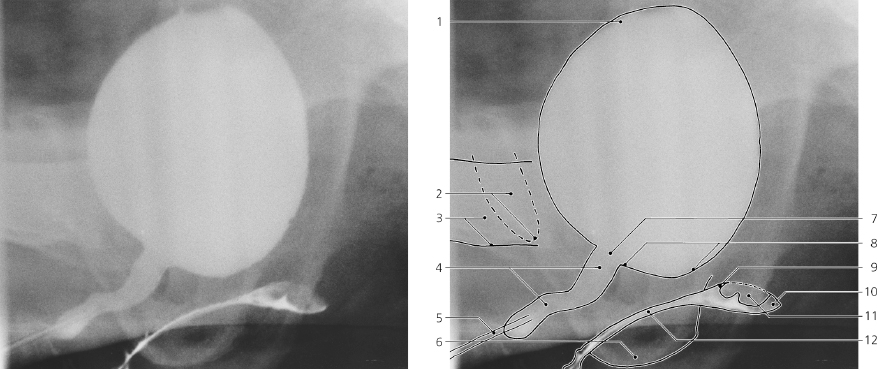 Bladder and Urethra | Radiology Key