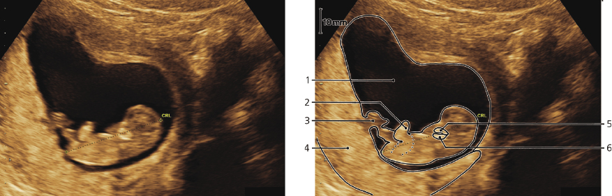 cmp57-fig-5868