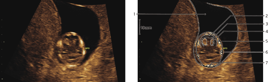 cmp57-fig-5869