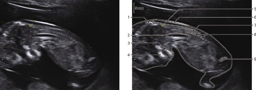 cmp57-fig-5870