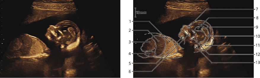 cmp57-fig-5871