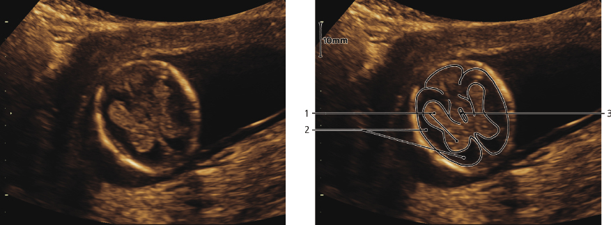 cmp57-fig-5872