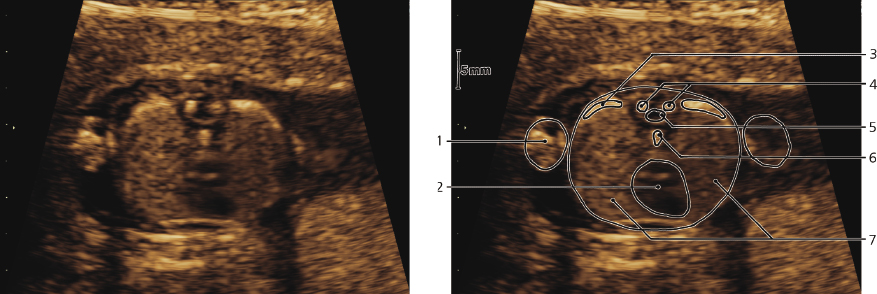 cmp57-fig-5873