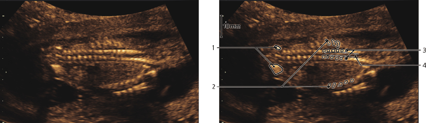 cmp57-fig-5874