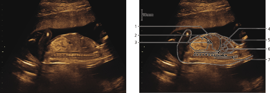 cmp57-fig-5875