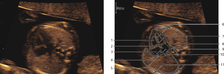 cmp57-fig-5876