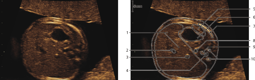 cmp57-fig-5878