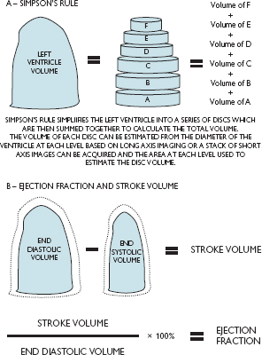 Left ventricular function | Radiology Key