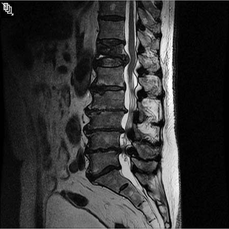 6 Myocardial Uptake | Radiology Key