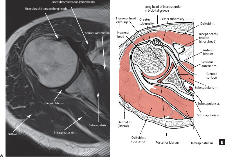 Normal Mri Anatomy Of The Musculoskeletal System Radiology Key