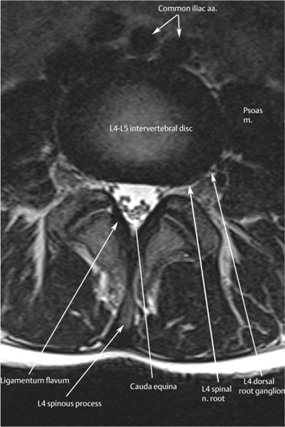 Normal MRI Anatomy Of The Musculoskeletal System | Radiology Key