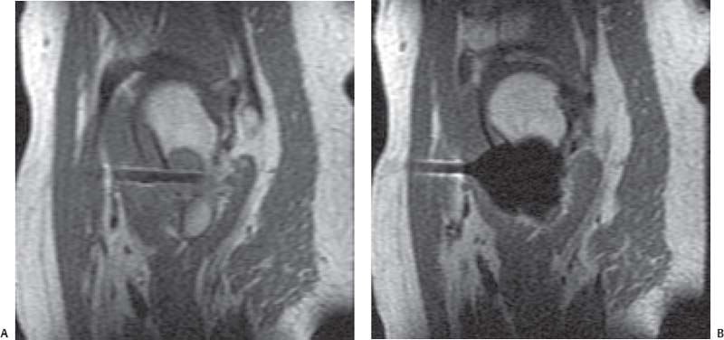 Advanced Techniques In Musculoskeletal MRI | Radiology Key