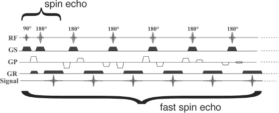 A schematic of the fast spin-echo or turbo spin-echo pulse sequence