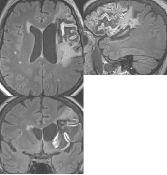 3D Imaging: SPACE | Radiology Key