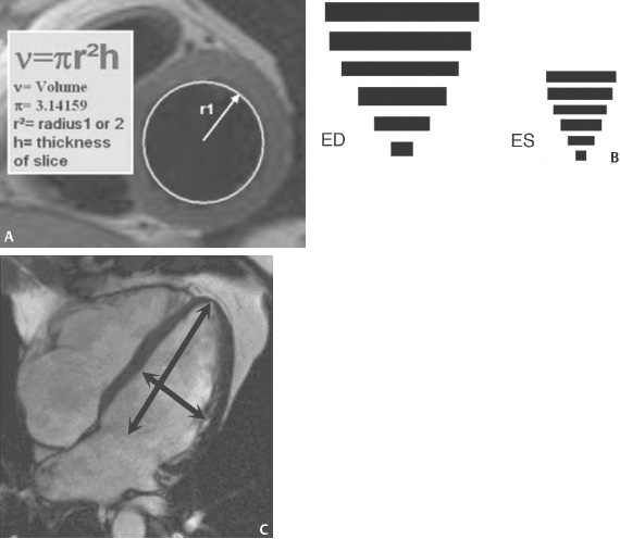 Matrix Size: Phase Encoding | Radiology Key