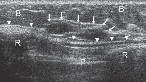 24 | Radiology Key