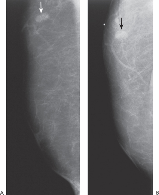 144 | Radiology Key