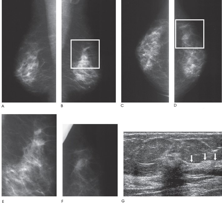 Ultrasound Technique And Cross—Correlation With | Radiology Key