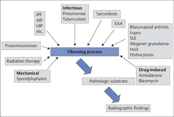 fibrosing-lung-disease-radiology-key