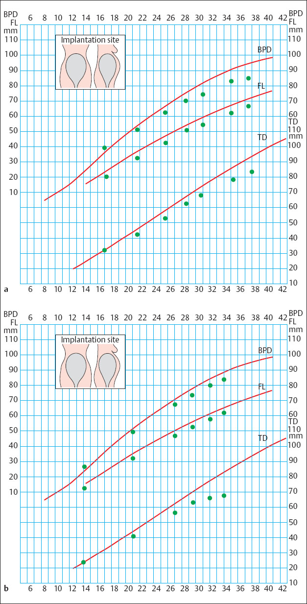 icd 10 ultrasound to confirm pregnancy