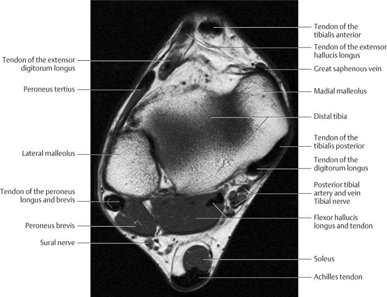 Ankle and Foot | Radiology Key