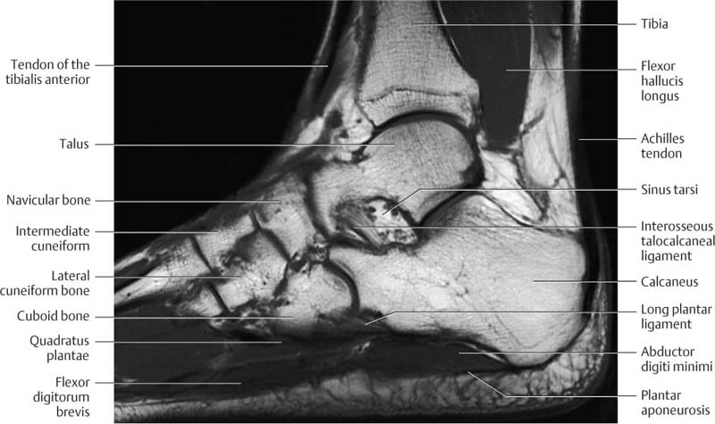 Ankle and Foot | Radiology Key