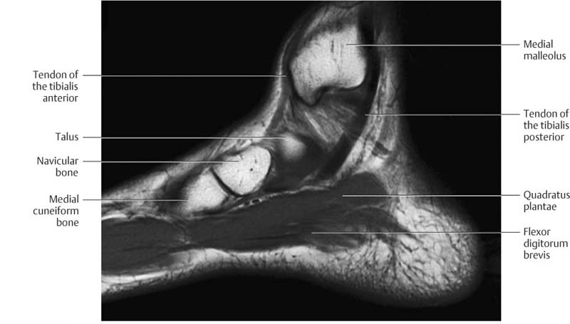 Ankle And Foot Radiology Key