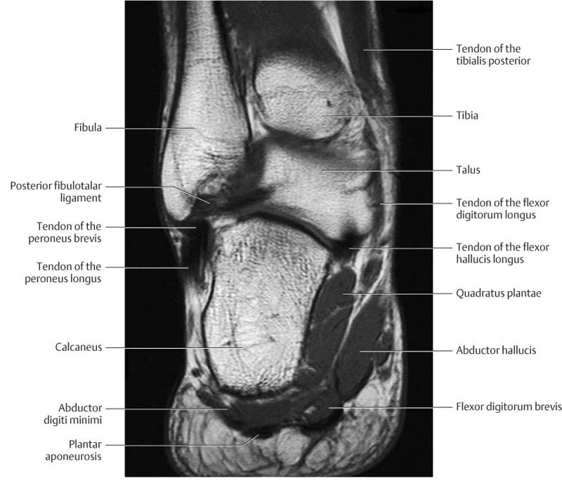 Ankle And Foot Radiology Key