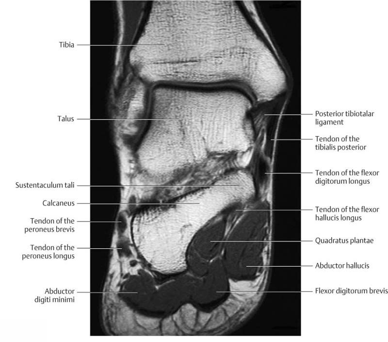 Foot Muscles Mri How My Foot Looks Using Mri Fascinating Why