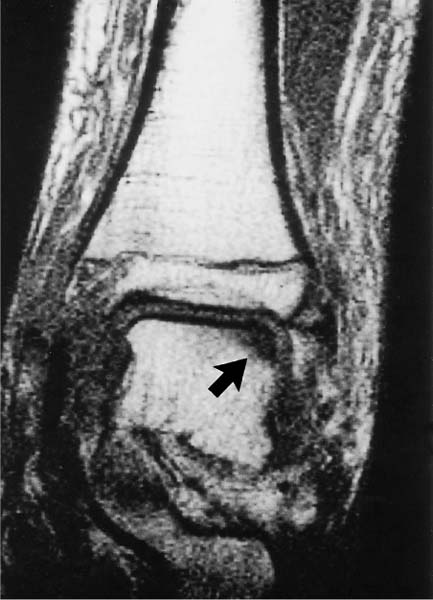 Ankle and Foot | Radiology Key