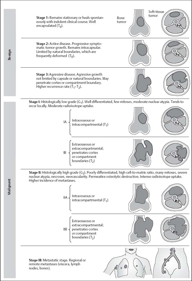 Bone And Soft Tissue Tumors Radiology Key