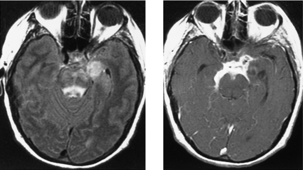 Opening Round | Radiology Key